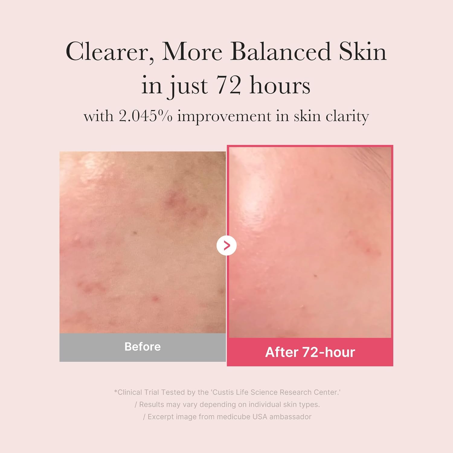 Medicube TXA + Niacinamide 15% Serum